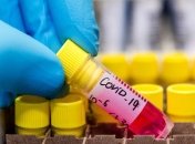 Фейки о COVID-19: В МОН рассказали о самых распространенных