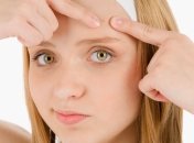 Как избавиться от навязчивых прыщей?