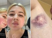 Садная после избиения