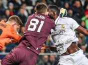 Кровавый гол "Реала": жуткий инцидент на последних минутах матча (видео)