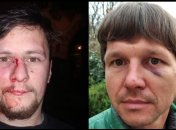 Душили, били по голове и лицу: ветеранов войны на Донбассе избили полицейские во Львове. Фото