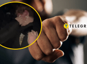 Избиение ребенка