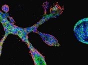 Ученым удалось штучно вырастить клетки молочной железы