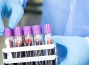 У столиці - 7 нових випадків коронавірусу