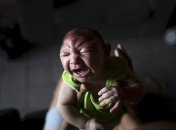 Ученые усомнились в том, что вирус Зика вызывает микроцефалию 