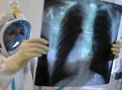 В Минздраве сделали неутешительный прогноз по COVID-19