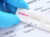 В Україні зафіксовано 6125 випадків коронавірусної хвороби COVID-19 