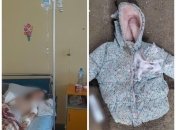 Бійцівські собаки жорстоко рвали 7-річну дівчинку та її матір посеред вулиці: подробиці НП на Київщині (фото)