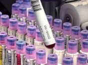 Коронавирус в Киевской области: подтвердили 1600 случаев