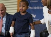 Восьмилетнему мальчику успешно пересадили кисти рук