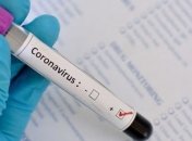 На Черкащині зафіксували понад 370 інфікованих Covid-19