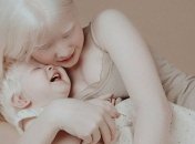 Теплые фотоснимки сестренок-альбиносок из Казахстана растопят ваше сердце (Фото)