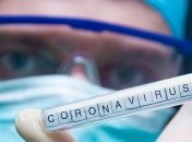 В Украине запустят производство ПЦР-тестов для выявления COVID-19