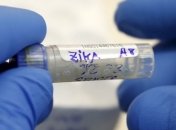 Прототип новой вакцины от вируса Зика признан работающим