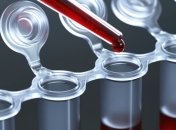 Новый анализ позволит определить риск смерти от инфекции