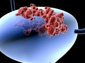 Японские медики научились диагностировать рак по анализу мочи