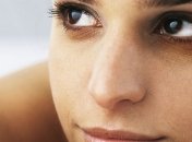 Темные круги под глазами и как с ними бороться 