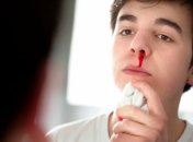 Почему идет кровь из носа и как ее остановить