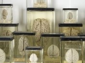 США: Из Техасского университета пропало 100 банок с мозгами