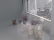 Как лечат раненых бойцов АТО частные больницы Киева?(Видео)