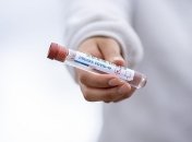 В Европе опасаются новой волны COVID-19