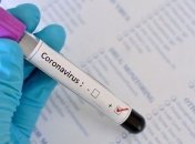 Медики наголошують, що тестування на коронавірус мають робити всі