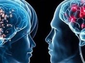 Обнаружены новые различия в мозге женщины и мужчины 