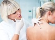 Простые средства, которые помогут избавиться от бородавок (Фото)