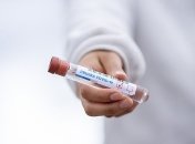 В Чехии - новый антирекорд по коронавирусу