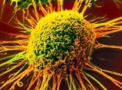 Ученые нашли эффективный способ борьбы с раком  