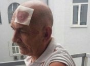 Генерал Романенко: Россия оказывает давление на президента Украины в деле передачи Цемаха