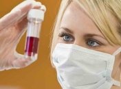 Ученые: назван город, от куда распространился ВИЧ