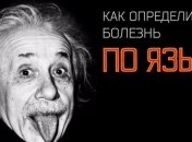 Что расскажет язык о вашем здоровье