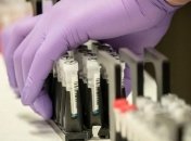 На Львівщині кількість хворих на коронавірус перевищила 450