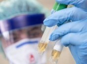 В Черкаській ОДА розповіли про першого інфікованого