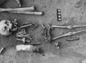 Найдены самые древние останки человека с синдромом Дауна