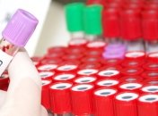 Анализ крови поможет определить потенциального самоубийцу