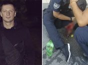 Руку собирали по крупинкам: показали фото травм подстреленного в Киеве полицейского (18+)