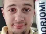 Пробка из-под минералки выстрелила парню в глаз: жертва ЧП записал эксперимент на видео