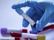 Стало відомо про стан дітей із коронавірусом