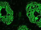 Устройство для смартфона, которое будет ставить диагноз человеку