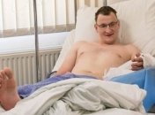 Впервые пациенту, родившемуся без конечности, пересадили руку