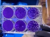 "Біофарма" починає проводити ІФА-тести донорів плазми, які перенесли COVID-19