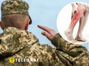 З якими хворобами ніг не мобілізують в Україні