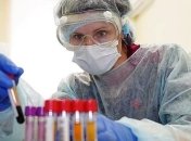 В Україні підтвердили 21 905 випадків коронавірусу, за добу - 321