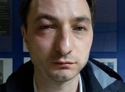 В Киеве избили главного врача Института рака