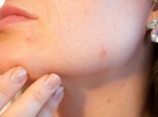 Признаки дефицита витамина С в организме