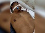 Пробудившийся в морге индус после семи часов "сна"