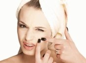 Ученые: Склонность к появлению прыщей передается по генах