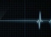 Сделали практически невозможное: украинские медики спасли женщину через 40 минут после остановки сердца